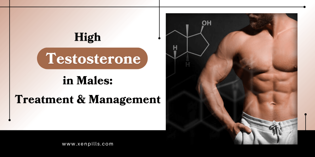 High Testosterone in Males - Treatment and Management